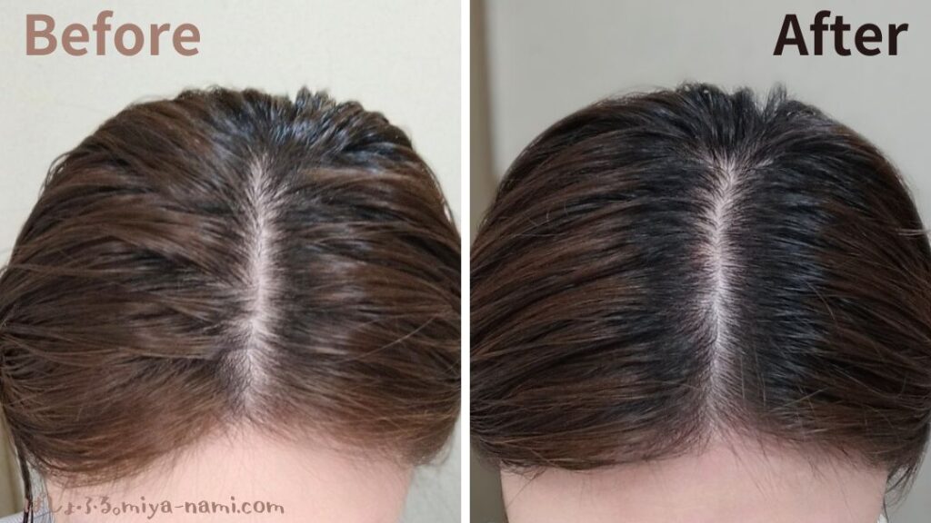 カレントボディ頭皮・薄毛ケアLEDヘルメットを使用した生え際、分け目が薄い女性の口コミ