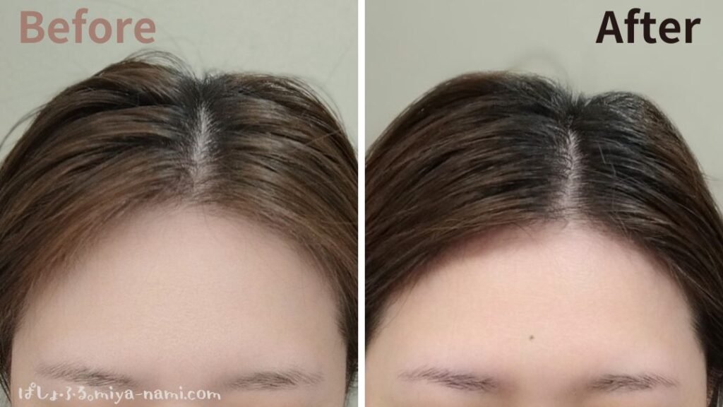 カレントボディ頭皮・薄毛ケアLEDヘルメットを使用した生え際、分け目が薄い女性の口コミ